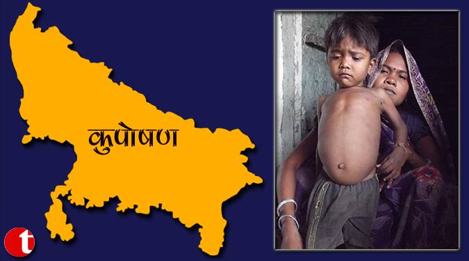 ७५ में से २९ जिले कुपोषित, नीति आयोग की सूची जारी