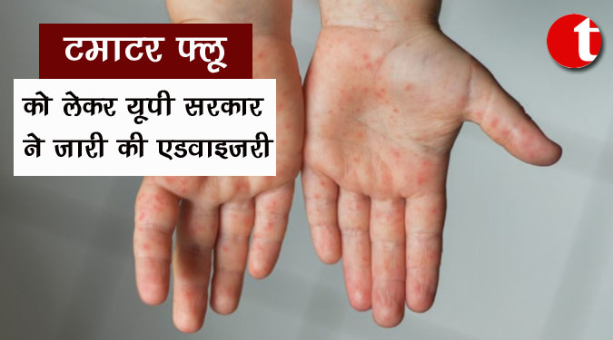 टमाटर फ्लू को लेकर यूपी सरकार ने जारी की एडवाइजरी